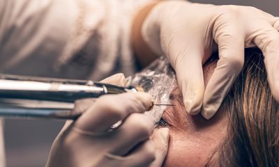 blefaroplastie cu laser